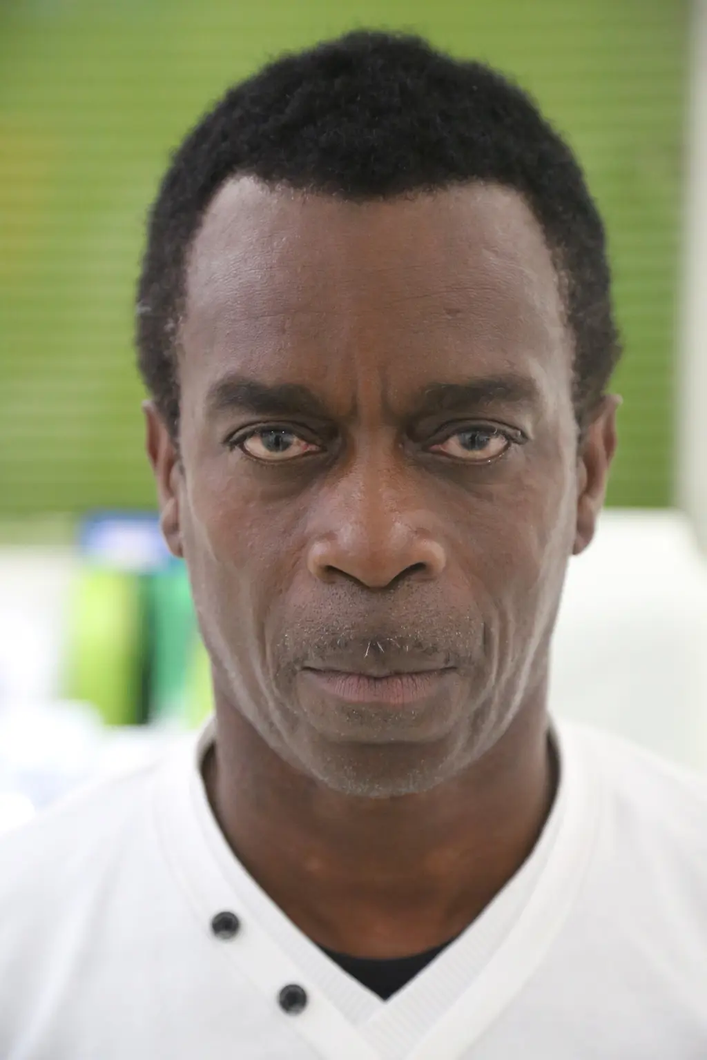 anti wrinkle gallery 01 before