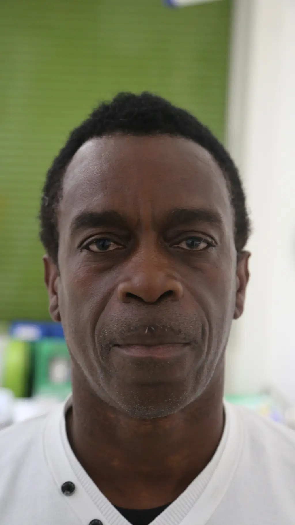 anti wrinkle gallery 01 before